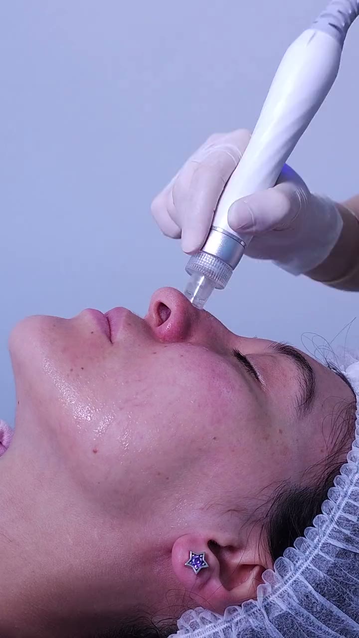 טיפול אנטי אייג'ינג בקליניקה של מיכל פאר